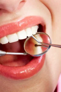 Diş Törpüleme Nedir? Nasıl Yapılır?