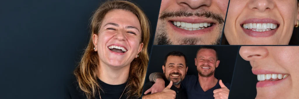 Conception du sourire at CADDENOVA Dental Clinic in Istanbul