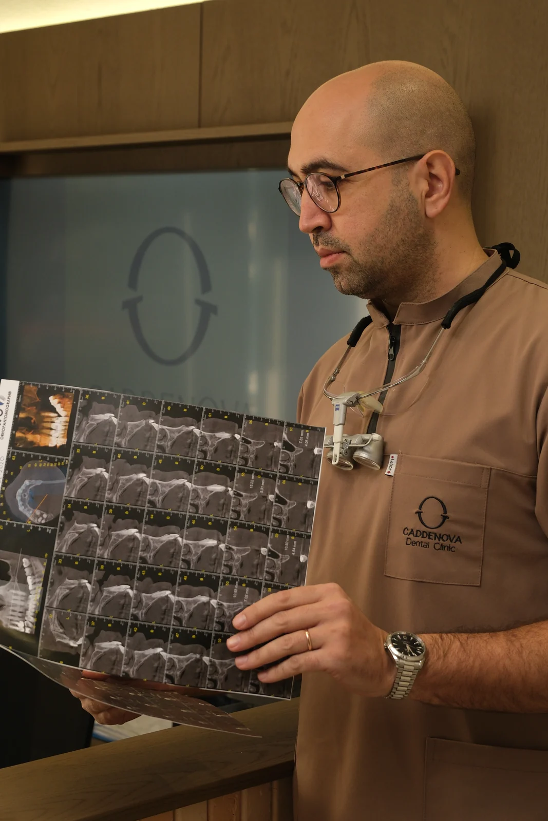 CADDENOVA’da zigoma implant tedavi planlaması için röntgen inceleyen hekim